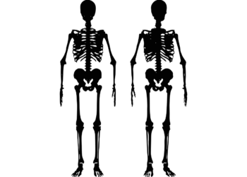 penyakit osteoporosis