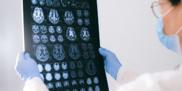 pemeriksaan radiologi