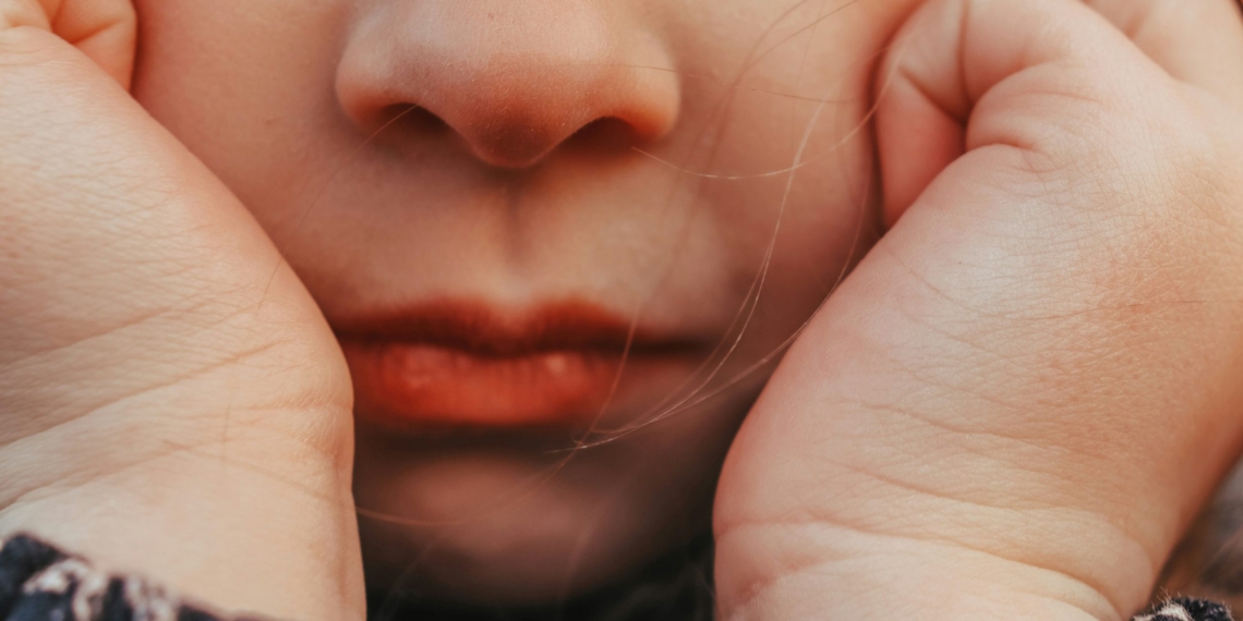 Ini Penyebab Penyakit Herpes pada Anak dan Cara Pengobatannya