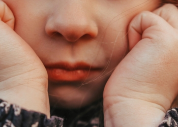 Ini Penyebab Penyakit Herpes pada Anak dan Cara Pengobatannya