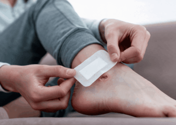 Perawatan Luka Kaki pada Pasien Diabetes untuk Mencegah Terjadinya Komplikasi